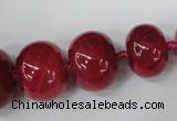 CAG5423 8*12mm – 20*30mm rondelle dragon veins agate beads