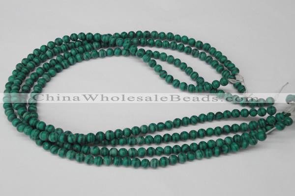 CRO52 15.5 inches 6mm round synthetic malachite beads wholesale
