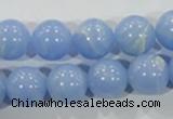 CTU1737 15.5 inches 16mm round synthetic turquoise beads