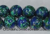 CTU1817 15.5 inches 16mm round synthetic turquoise beads